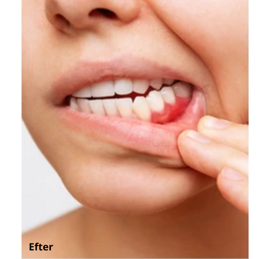 Dentaclean™ Pro 2.0