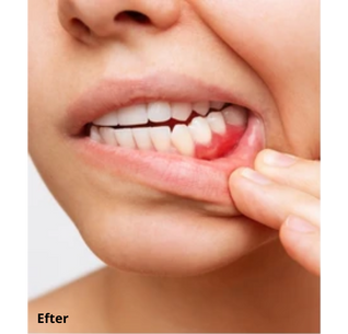 Dentaclean™ Pro 2.0