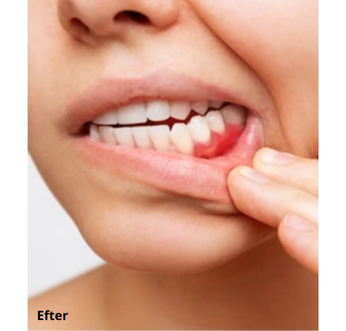 Dentaclean™ Pro 2.0
